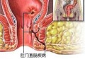 2018年5月17日 (四) 10:09的版本的缩略图